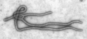 Transmission electron micrograph causative RNA filovirus of Ebola. Photo courtesy of CDC:Cynthia Goldsmith.